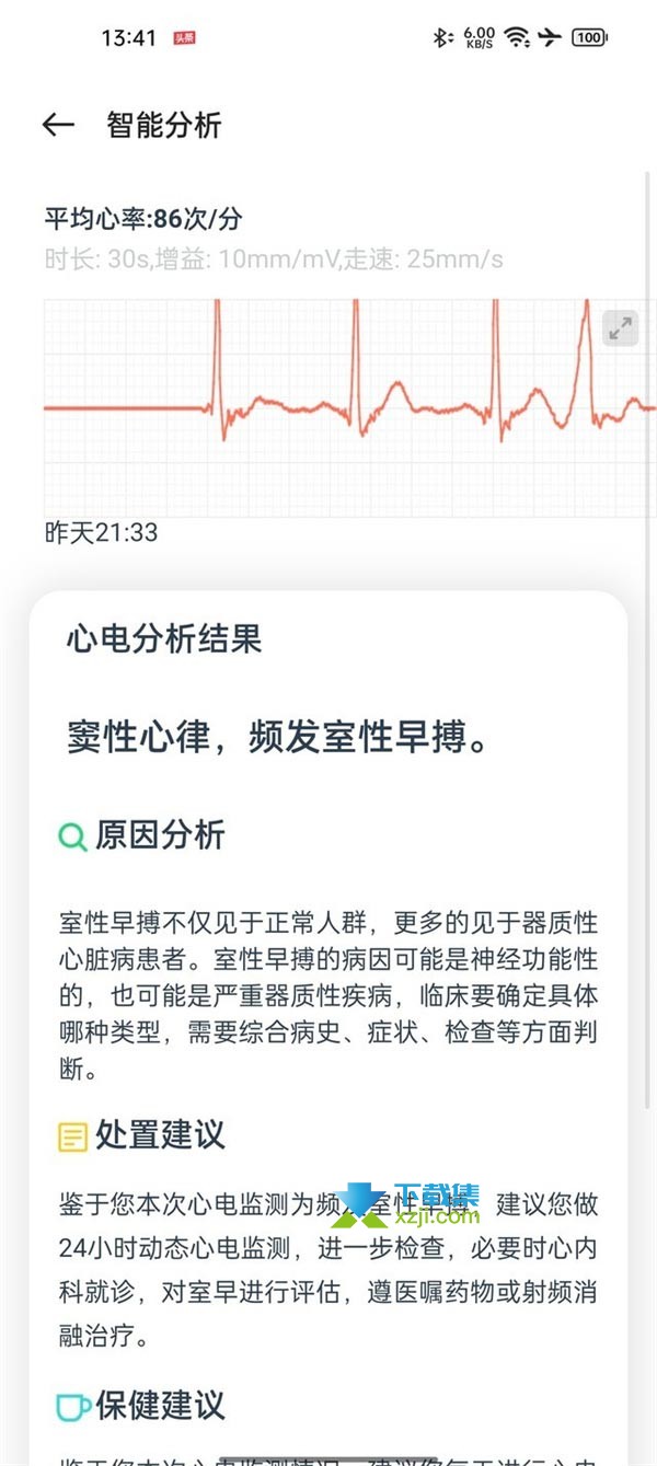 oppowatch2 ECG版与普通版区别在哪 哪个版本适合购买