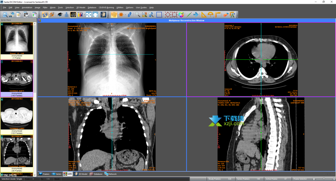 Sante DICOM Editor界面2