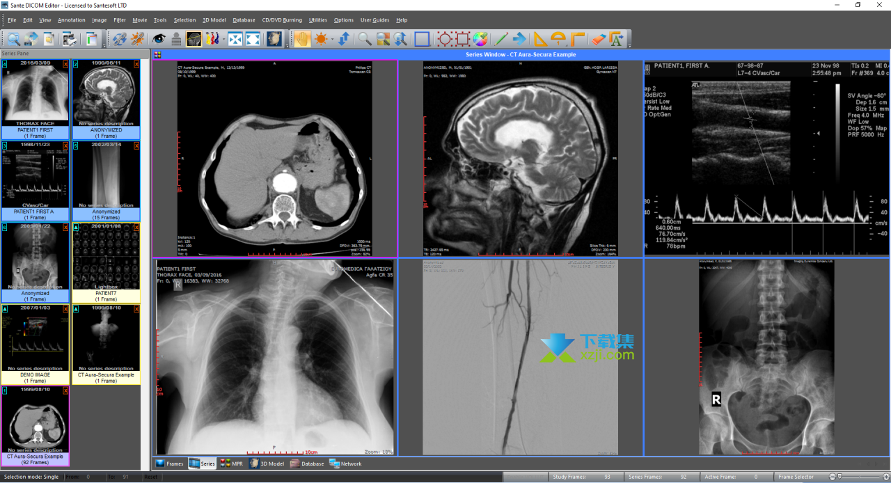 Sante DICOM Editor界面1