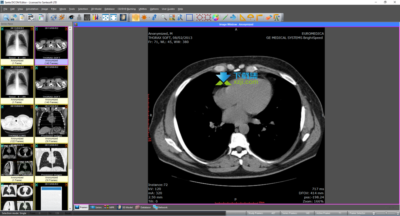 Sante DICOM Editor界面