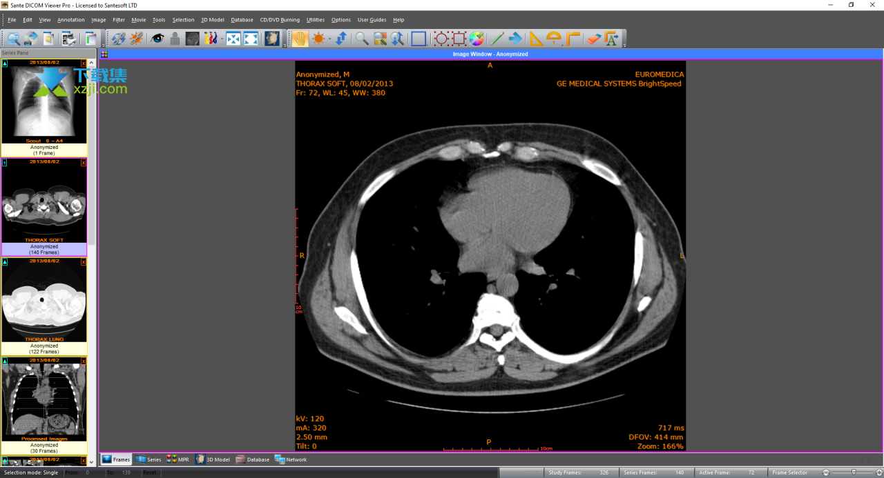 Sante DICOM Viewer Pro界面1